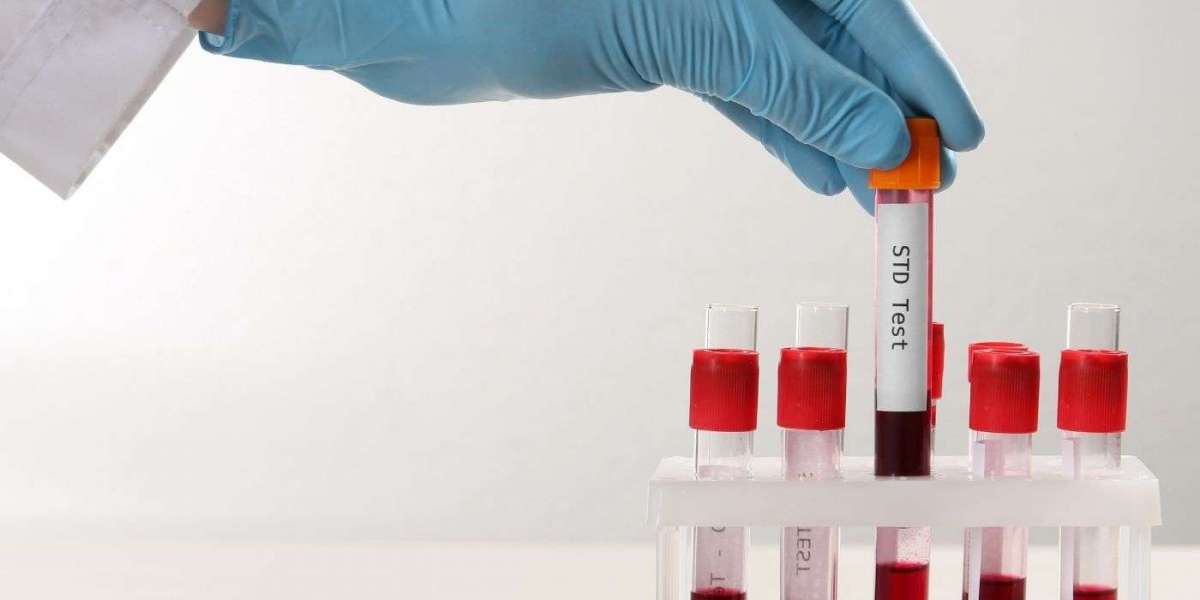 Why More People Are Choosing At-home STD Screening?