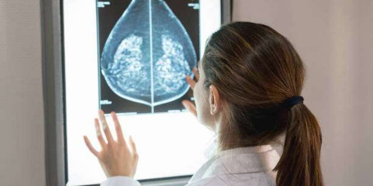 Trusted Breast Cancer Doctor in Nagpur Dr. Sameeksha Dubey