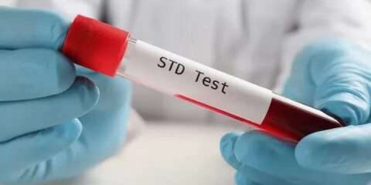 How to Prepare for a Trichomoniasis Test?
