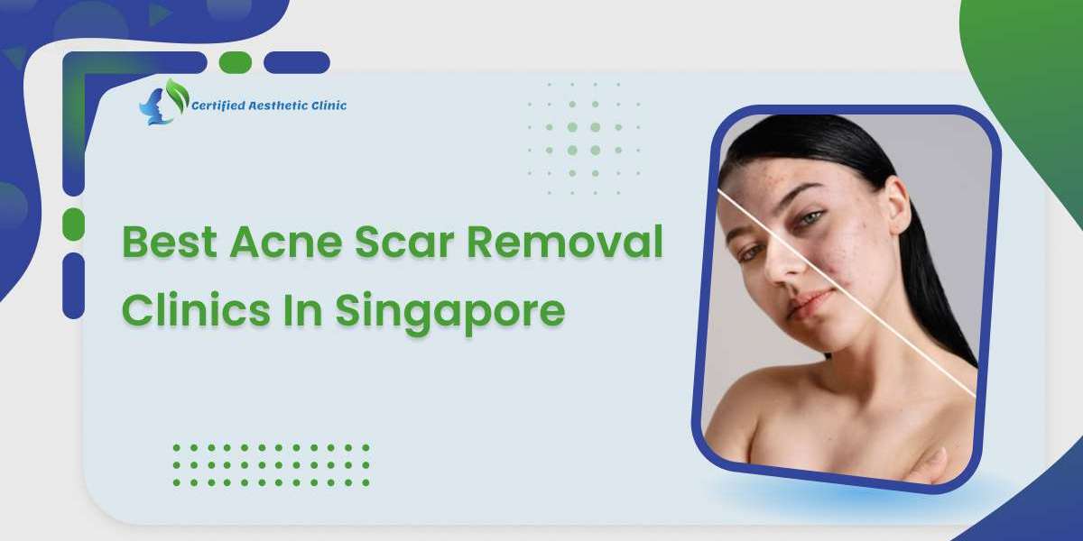 Best Acne Scar Treatment Singapore for Clearer, Smoother Skin