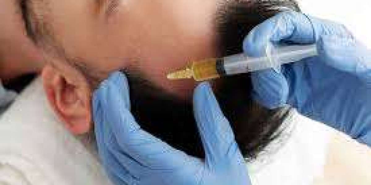 Hair PRP Treatment in Indirapuram | The Skin Global