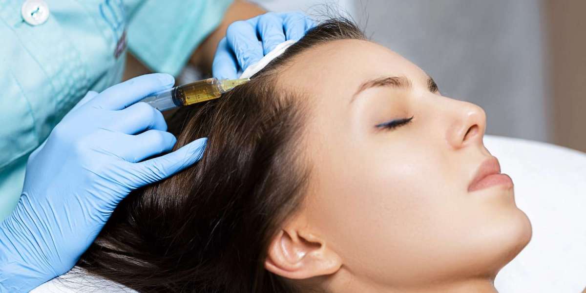 PRP Hair Treatment Recovery Time and Daily Activity Guidelines