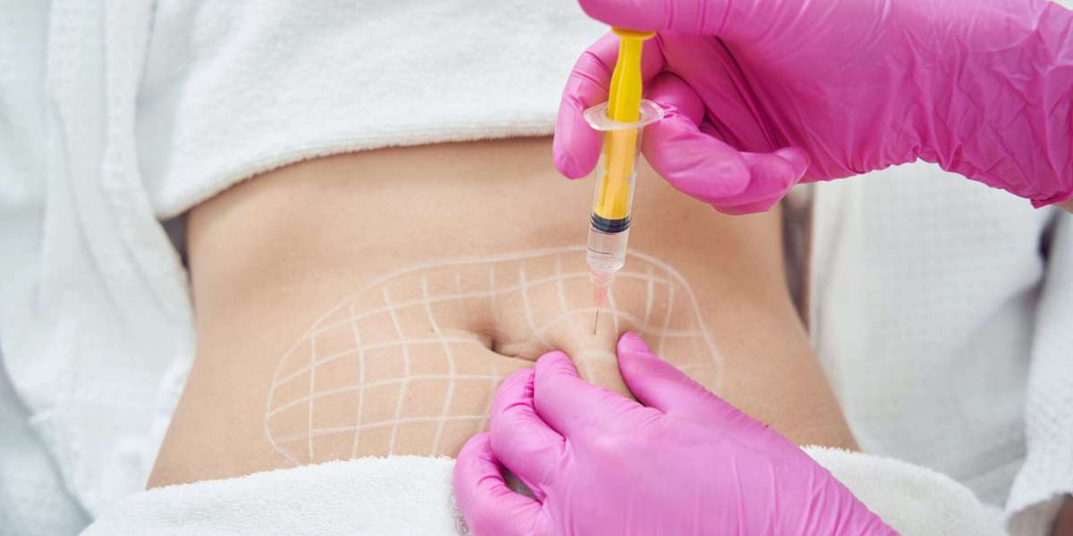 Benefits of fat dissolving needles over traditional liposuction