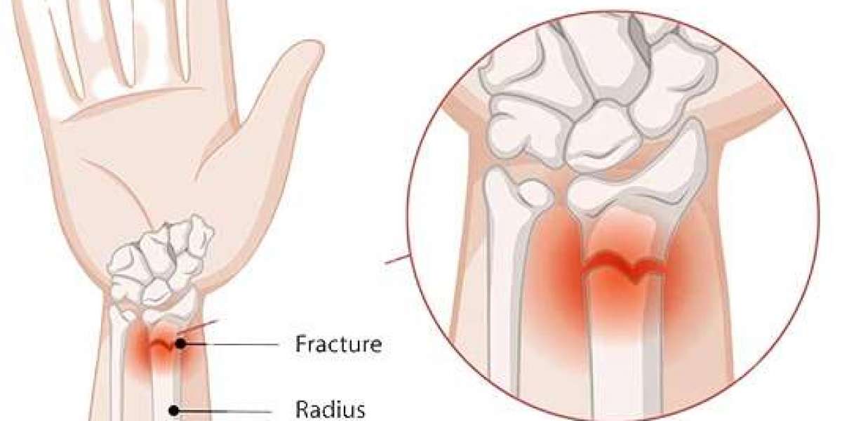 Pain Management in Fracture Care Guide