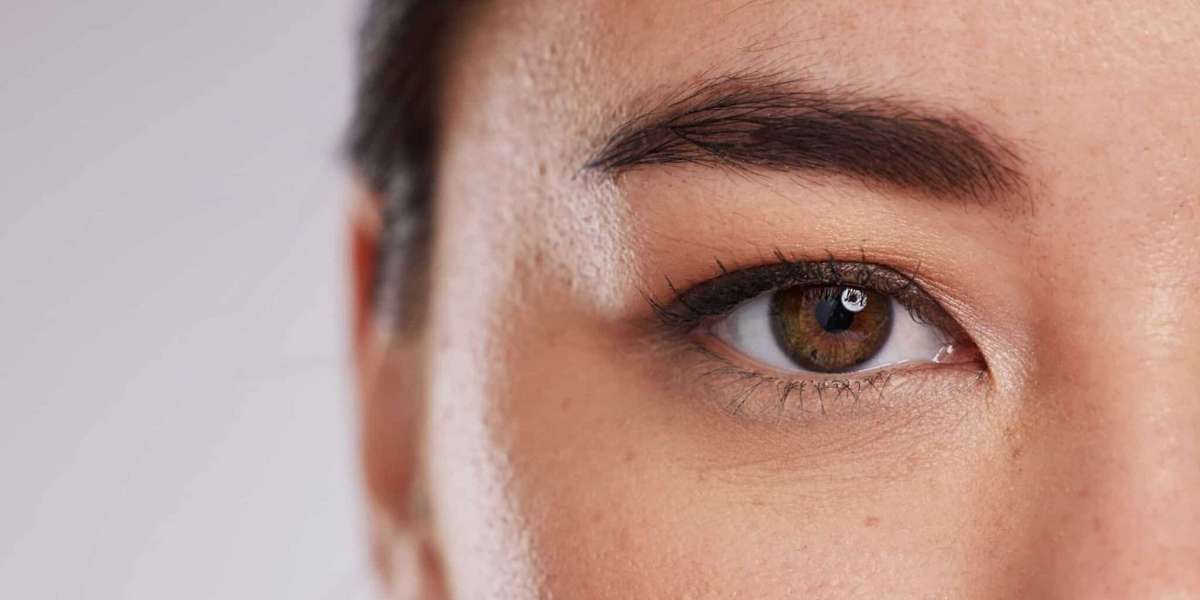Upper Blepharoplasty Dubai: Lift Droopy Eyelids