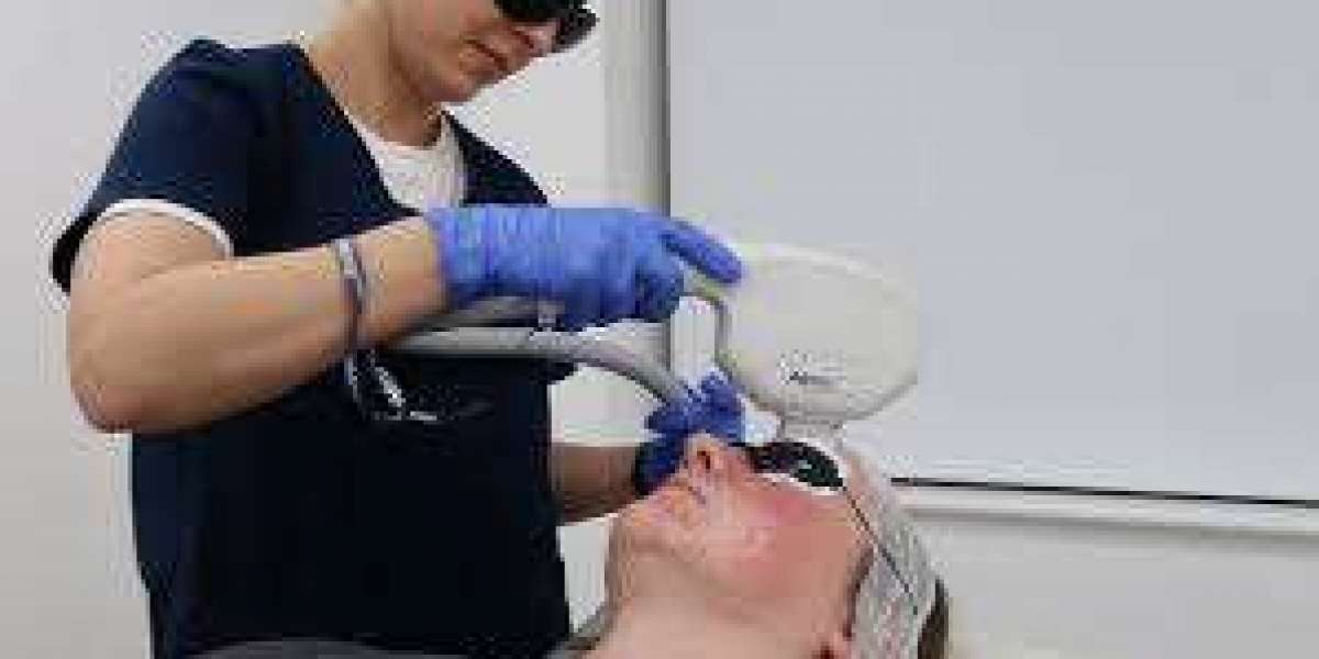 Laser For Pigmentation In London: Modern Laser Dermatology Solutions for Dark Spots
