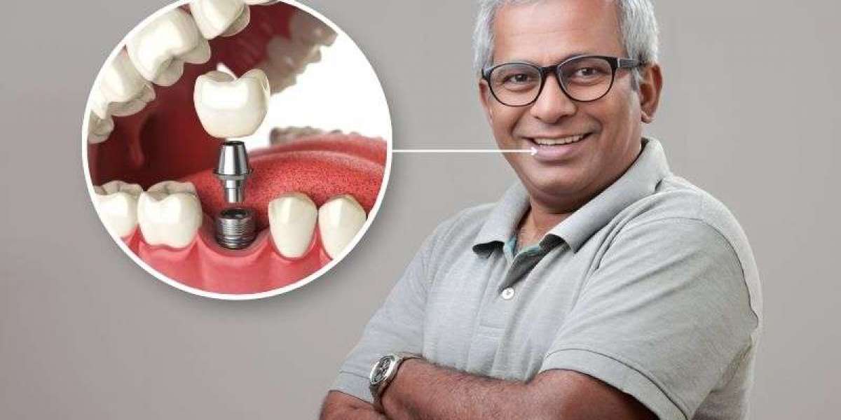 Transform Your Smile with Advanced Tooth Replacement Solutions in Gota, Ahmedabad