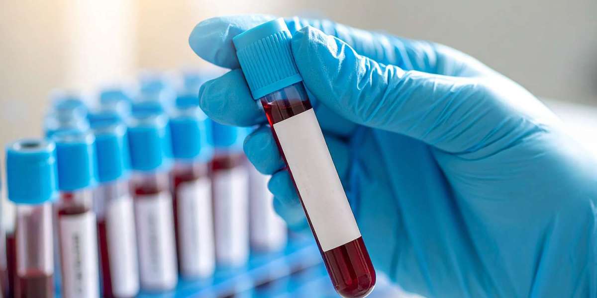 What to Expect During Your Visit to a Blood Test Center