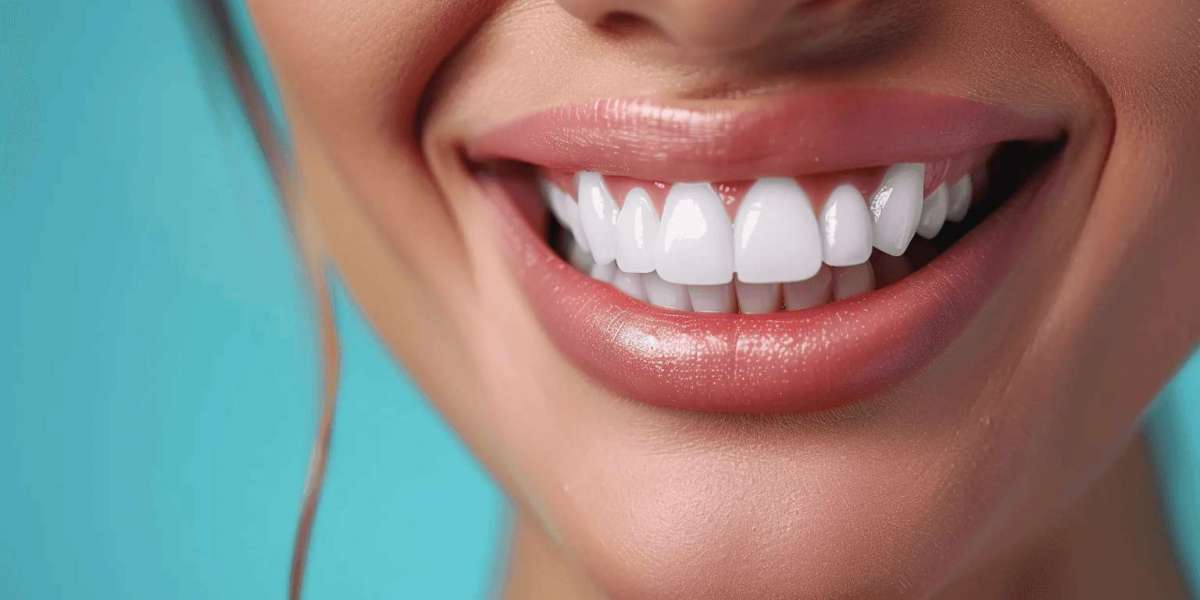 Best Teeth Whitening Options for Sensitive Teeth