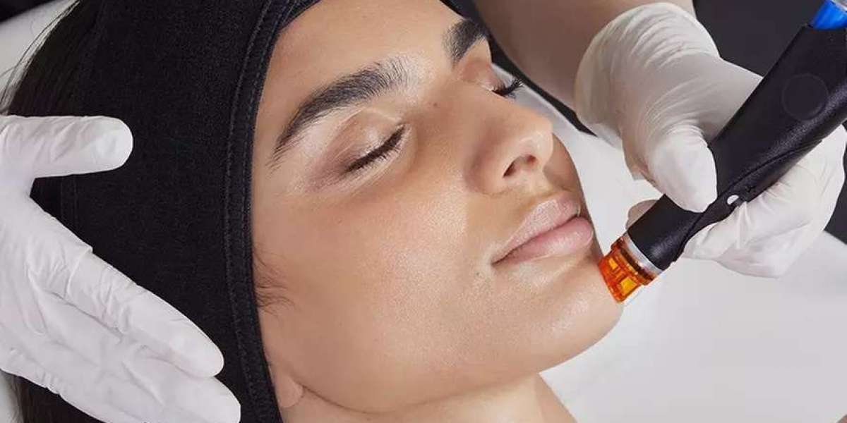 What Influences Laser Hair Removal Cost in Dubai for Arms?