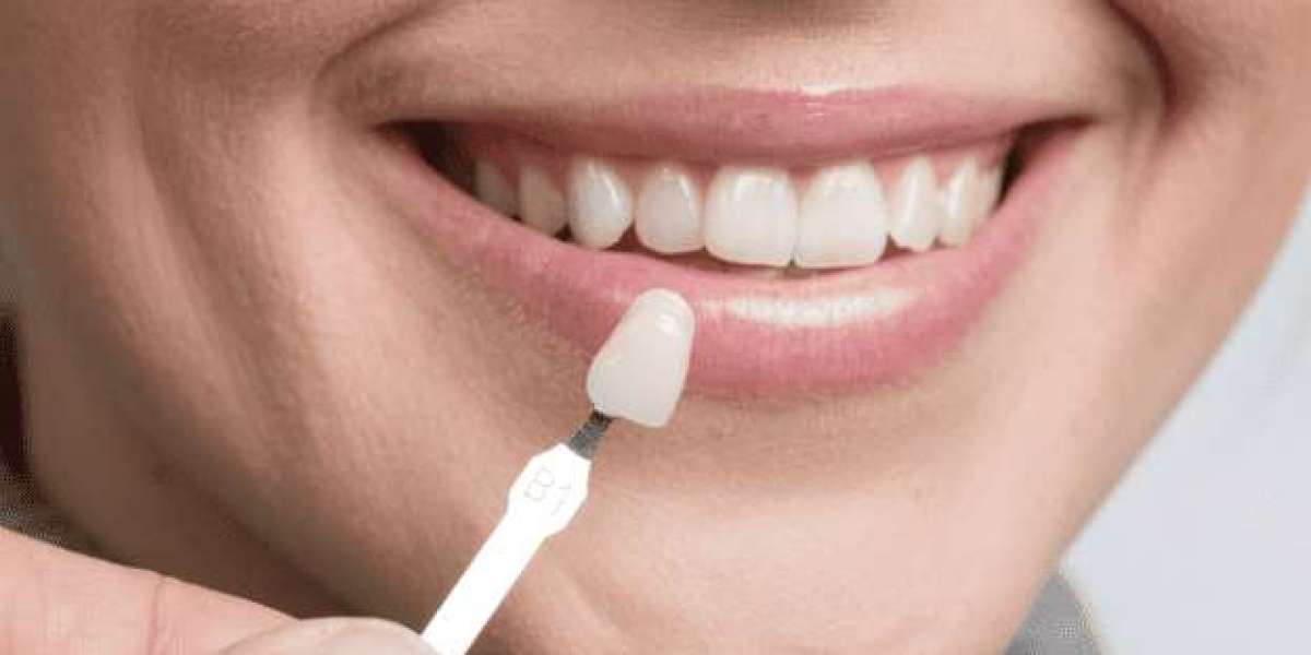 Cosmetic Dentist Dubai: Transform Your Smile with Experts