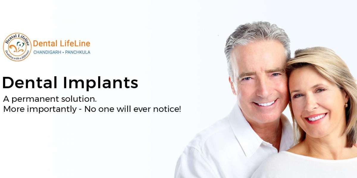 Most Trusted and Advanced Dental Implants in 2026