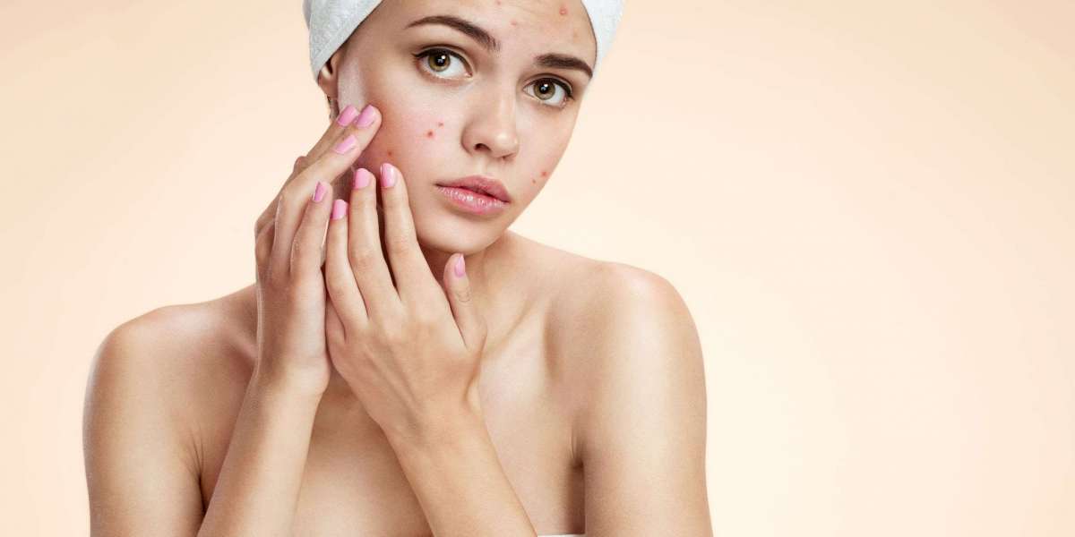 How Glora MD Helps Reduce Pores and Boost Skin Glow Naturally