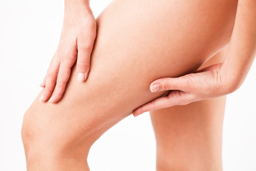 Laser Vein Removal Treatment | Spider Veins & Angioma Care
