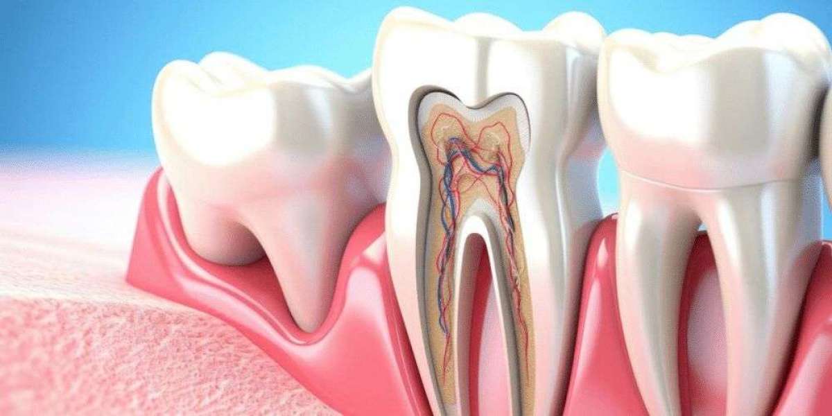 Painless Root Canal Treatment in Nadiad | Advanced Dental Care