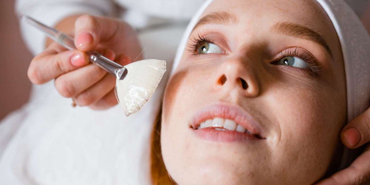 How Chemical Peels in Islamabad Can Transform Your Skin
