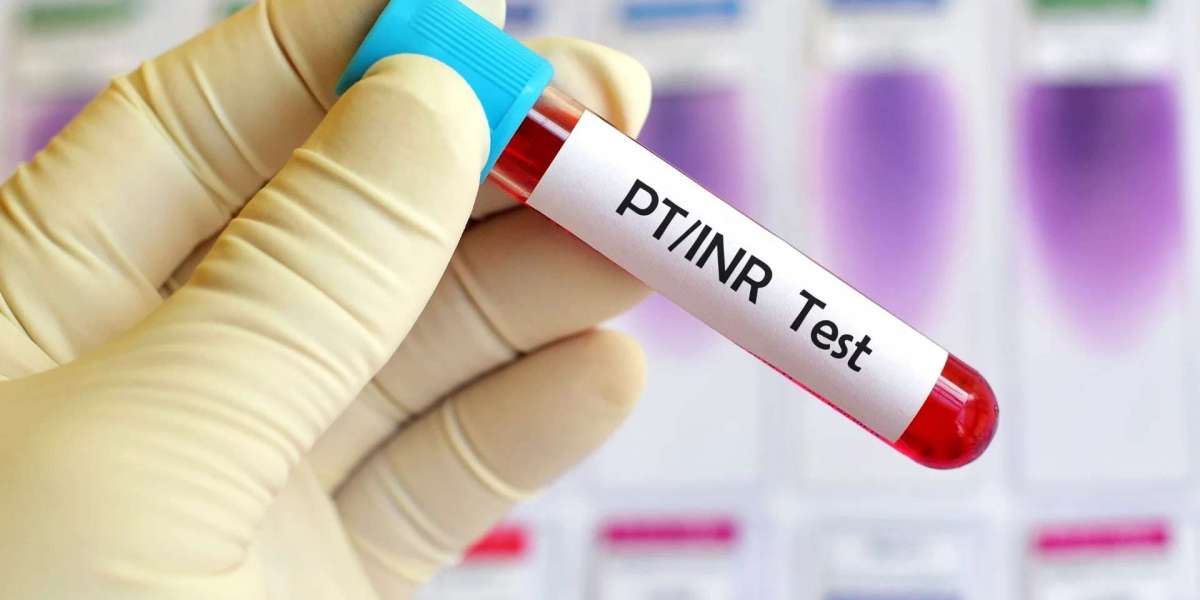 Prothrombin Time: An Essential Blood Test