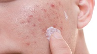 Derma PCD Franchise | Derma PCD Company | Skin Care Products Franchise | Derma Pharma Company