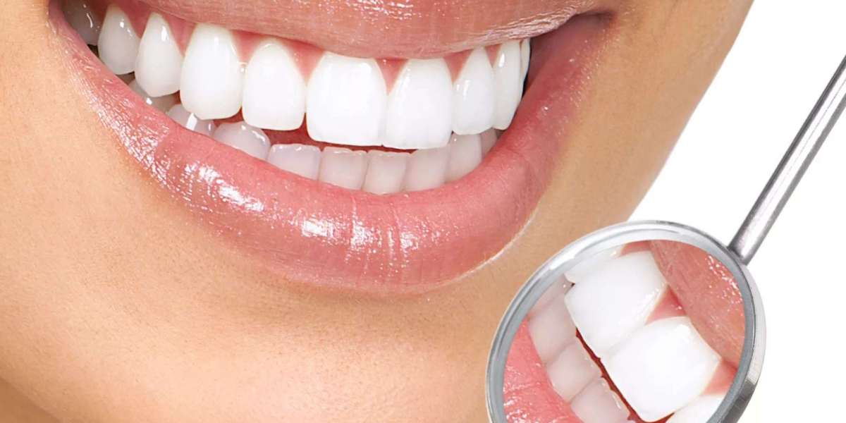 How to Get Bright Smiles with Affordable Teeth Whitening in Bhandara