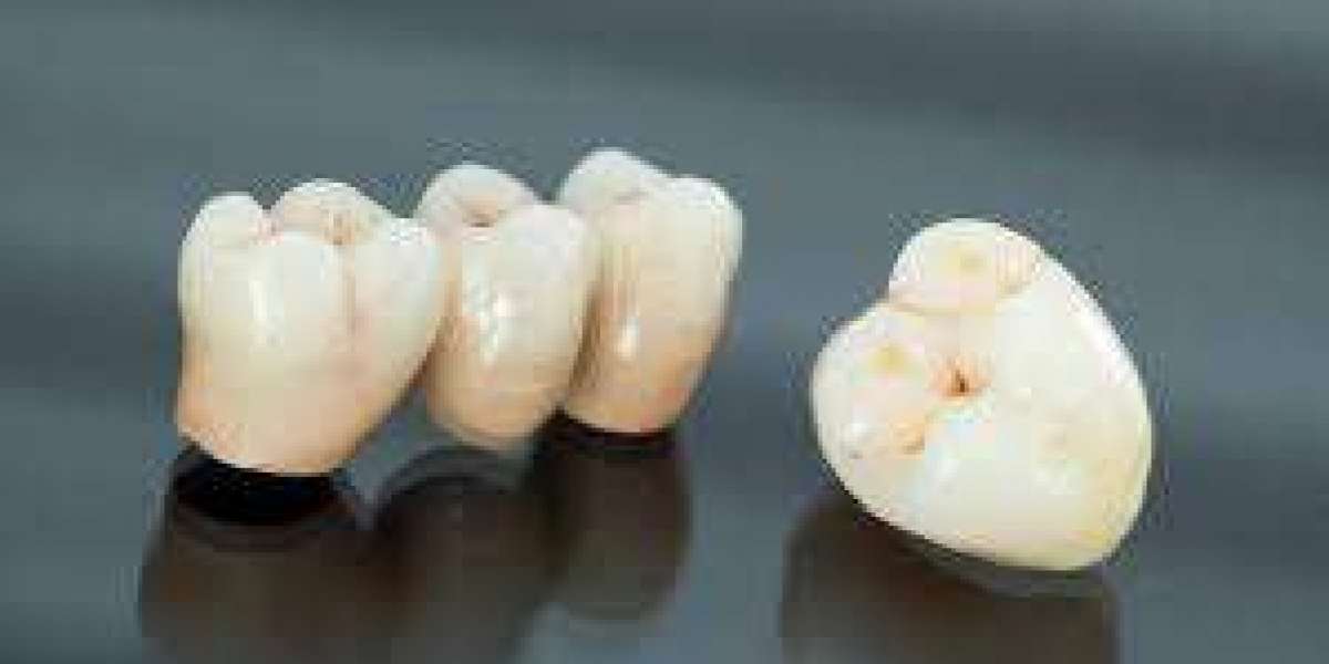 How Dental Crowns and Bridges in Thakur Village Restore Your Smile and Function
