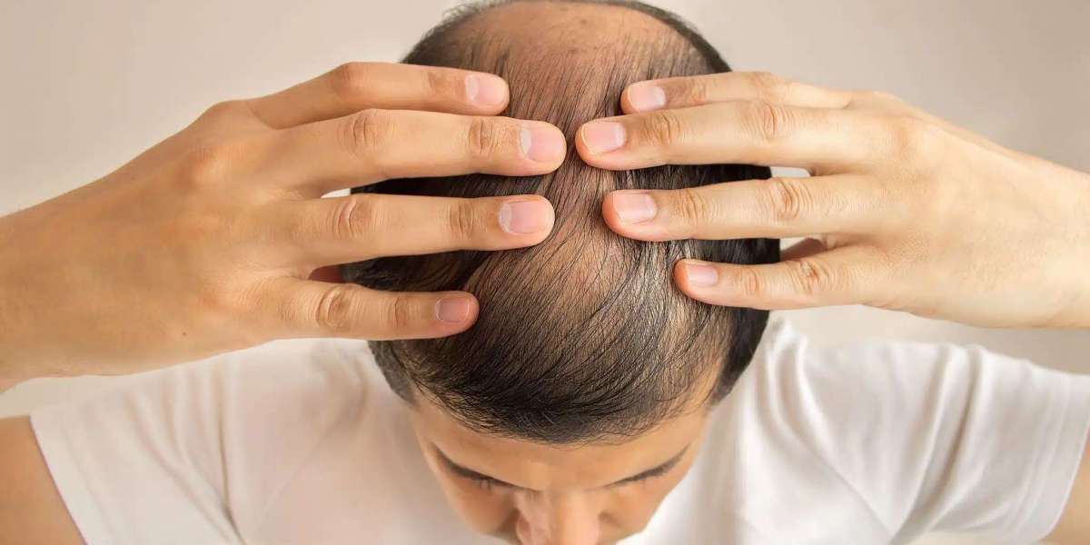 The Ultimate Guide to Hair Health and Growth: Strengthening from the Roots