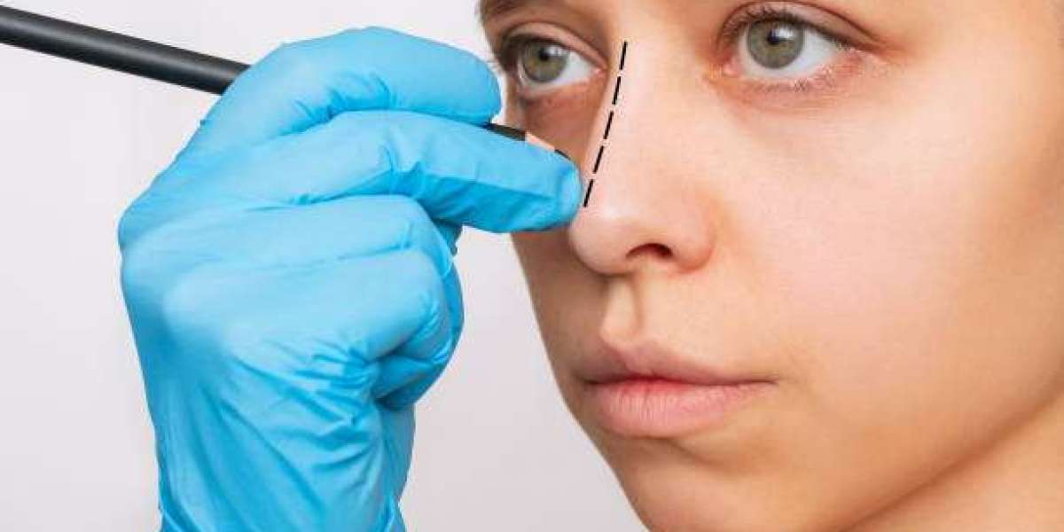 تجميل الأنف للسيدات في دبي: لمسات أنثوية رقيقة وتنافسية جمالية