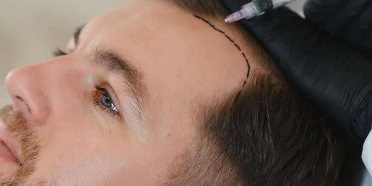 Hair Loss Treatment in Dubai: Advanced Clinical Care for Hair Fall Control and Regrowth