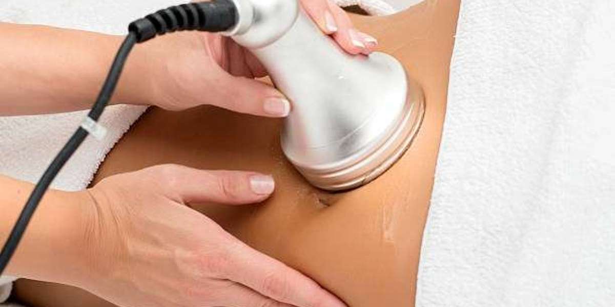 Best Laser Liposuction NJ for Body Contouring