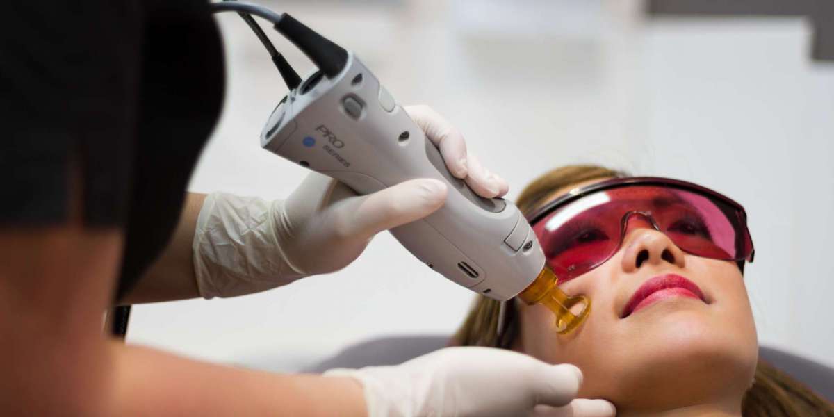Laser Hair Removal in Dubai: Your Complete Guide to Smooth Skin