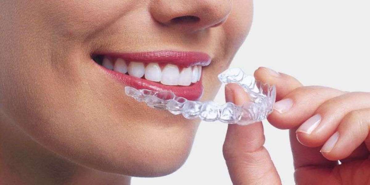 Comfort Meets Aesthetics: The Rise of Invisalign Treatment