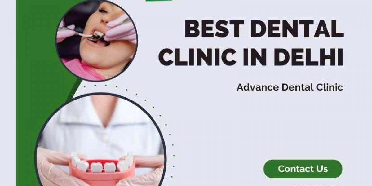 Best Dental Clinic in Delhi for Your Smile
