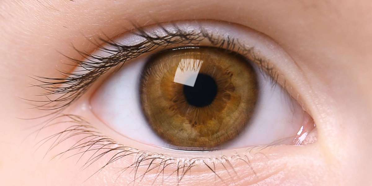 https://www.facebook.com/groups/visionrestorationnz
