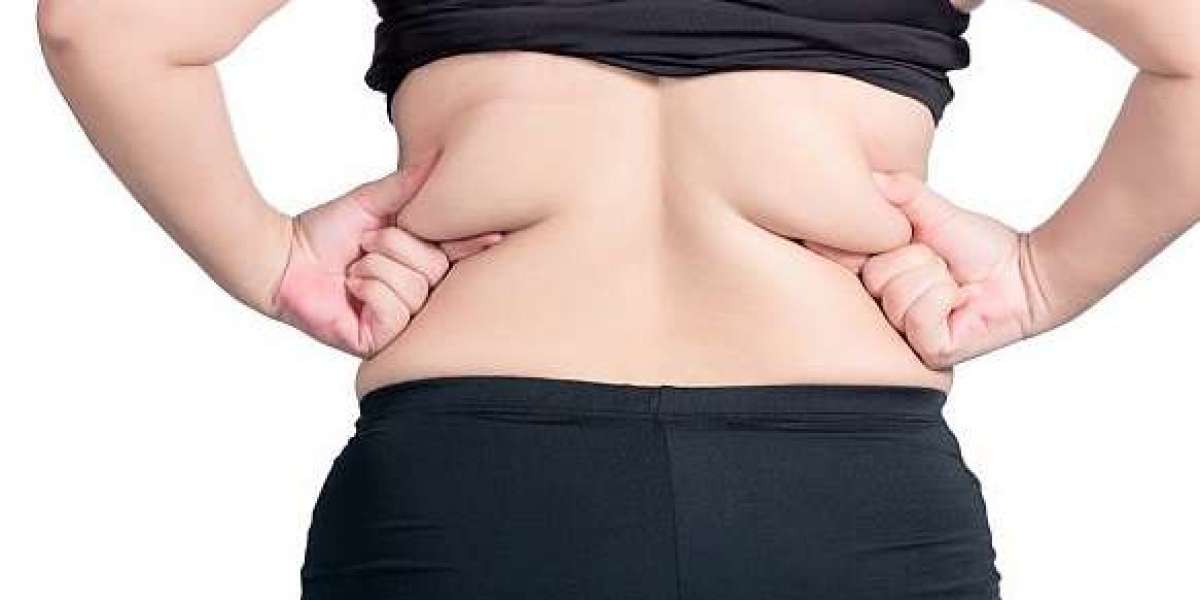 Mini vs Full Tummy Tuck in Islamabad: Which One is Right?