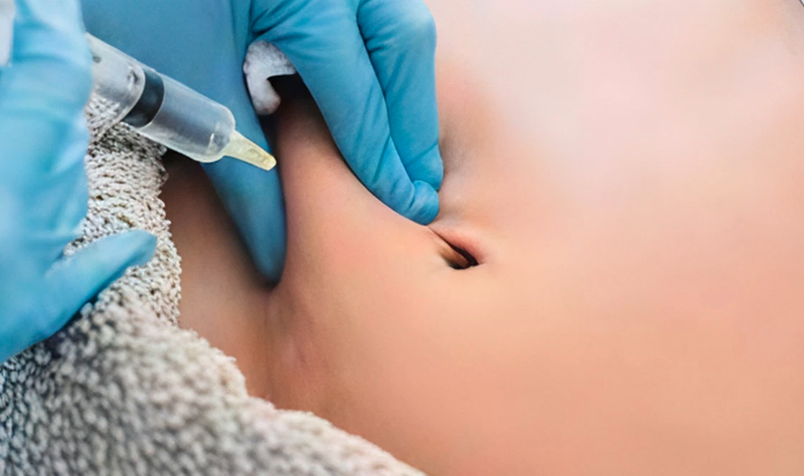 Aqualyx Fat Dissolving Injections – Non-Surgical Fat Loss