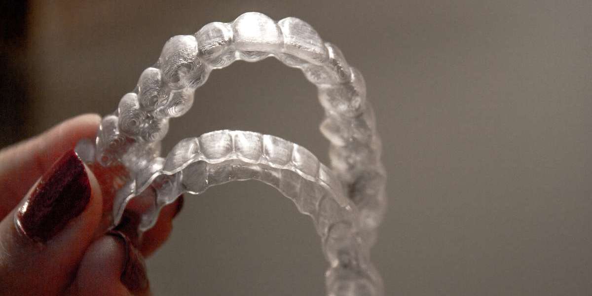 Why Invisible Teeth Alignment Is Better Than Traditional Braces