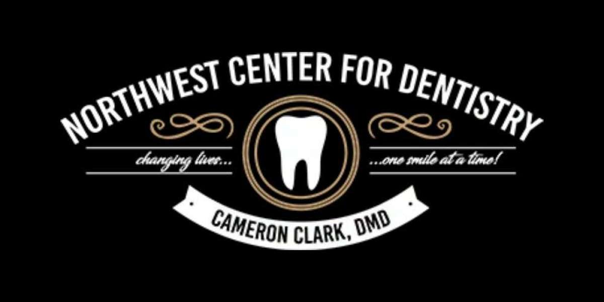 Advanced Dental Implants Kalispell MT for Lasting Smile Solutions