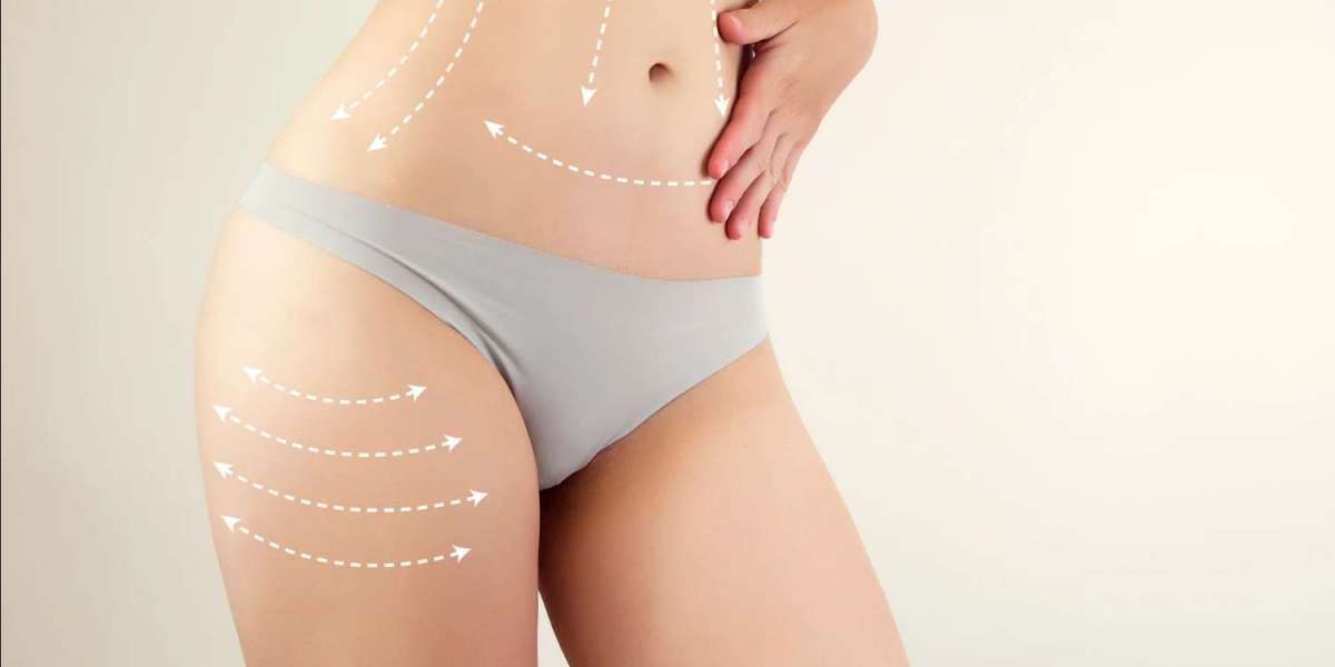 Success Surgery Tips by Best Liposuction Surgeons in Dubai