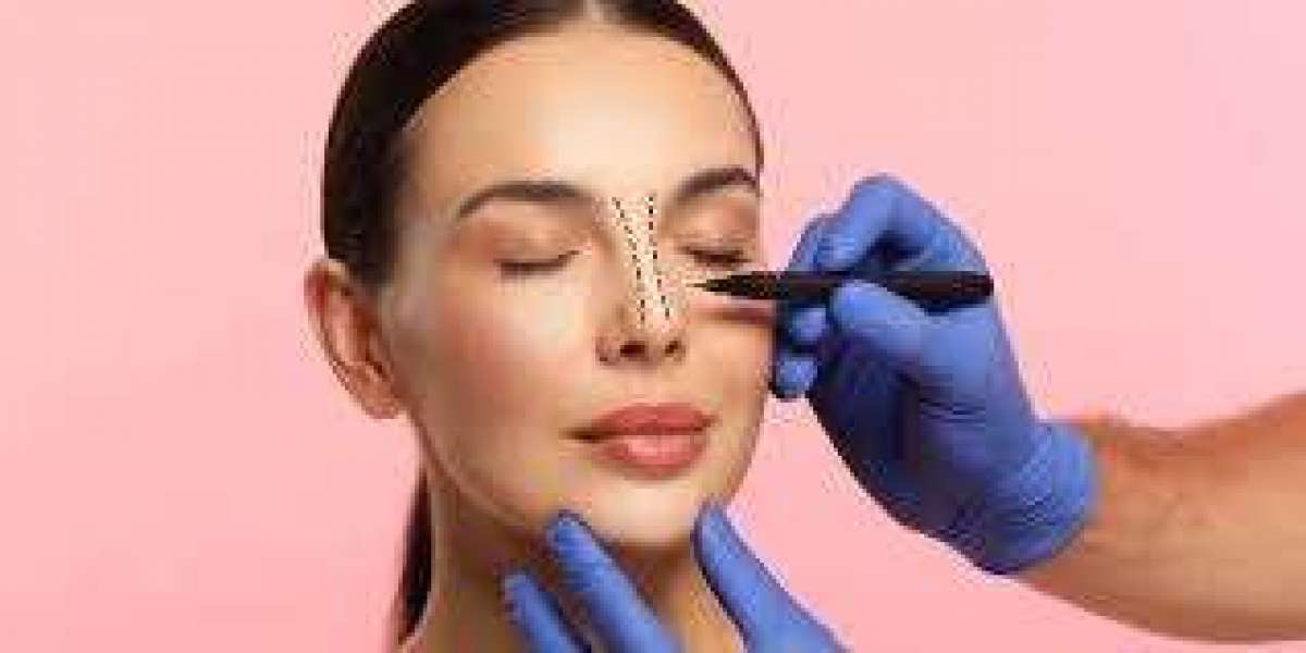 Harmonized Facial Features through Rhinoplasty in Islamabad at Glamorous Aesthetic Clinic