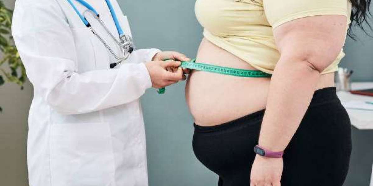 Long-Term Results of Obesity Treatment Dubai