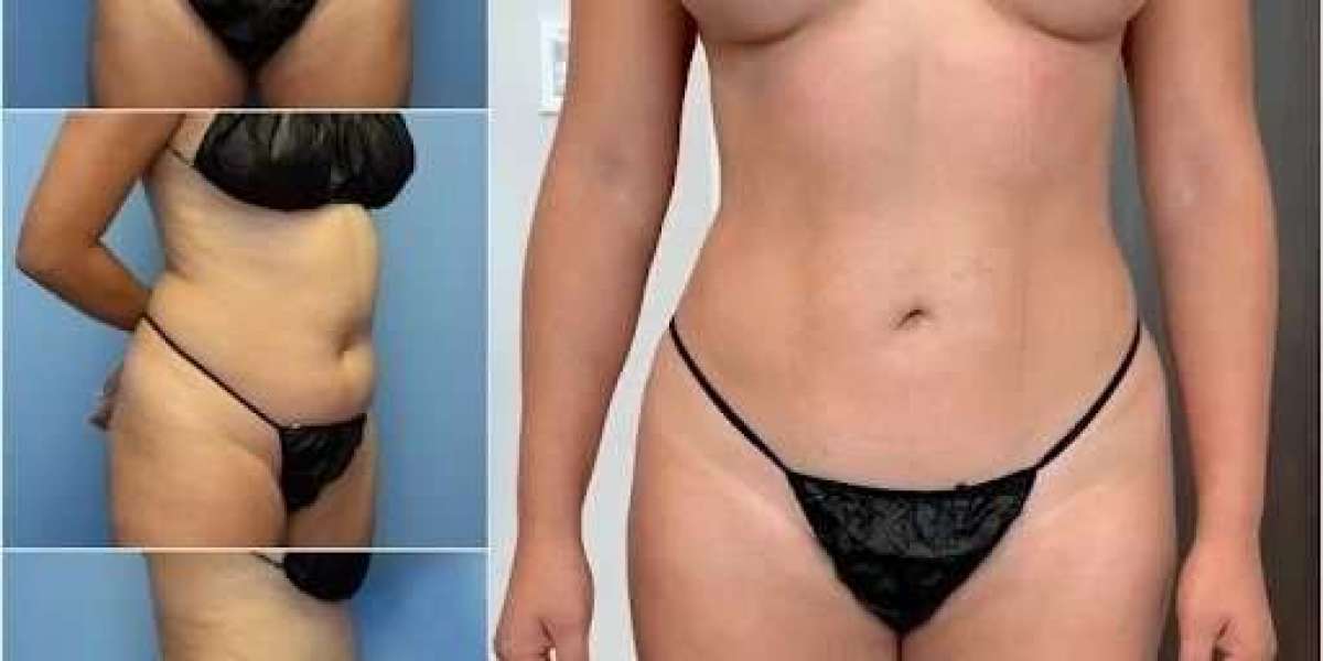 Body Contouring in Dubai: Innovative Cosmetic Procedures
