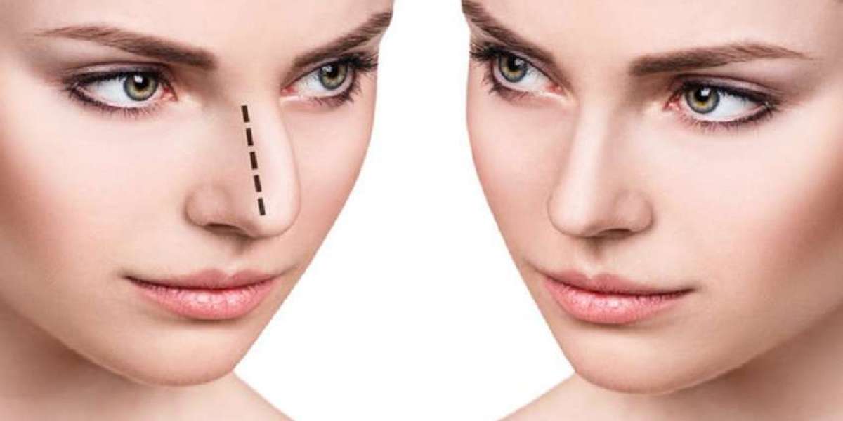 تجميل الأنف الوظيفي والتجميلي: كفاءة طبية لا تضاهى في دبي