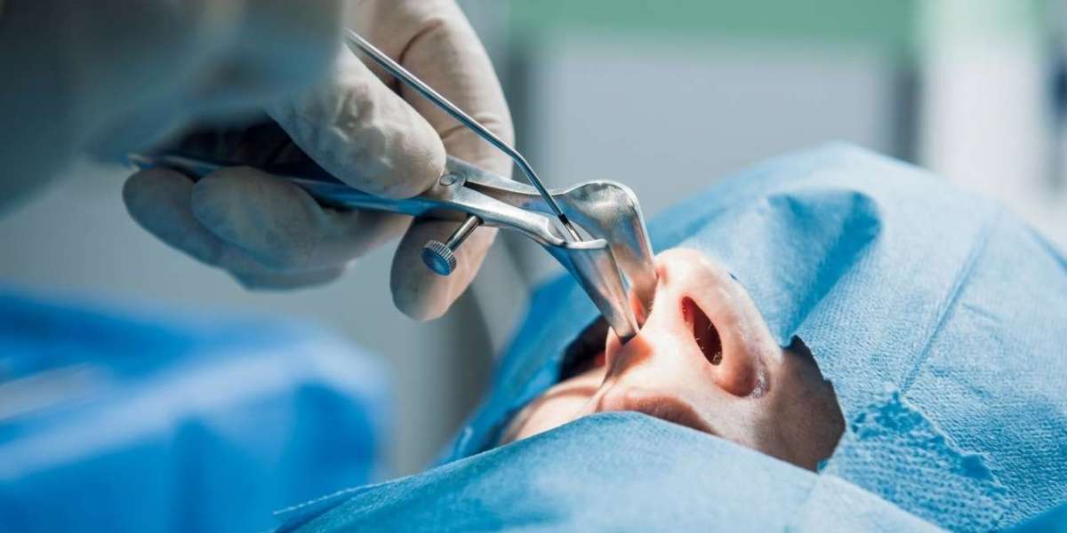 Endoscopic Sinus Surgery A Modern Solution for Lasting Sinus Relief