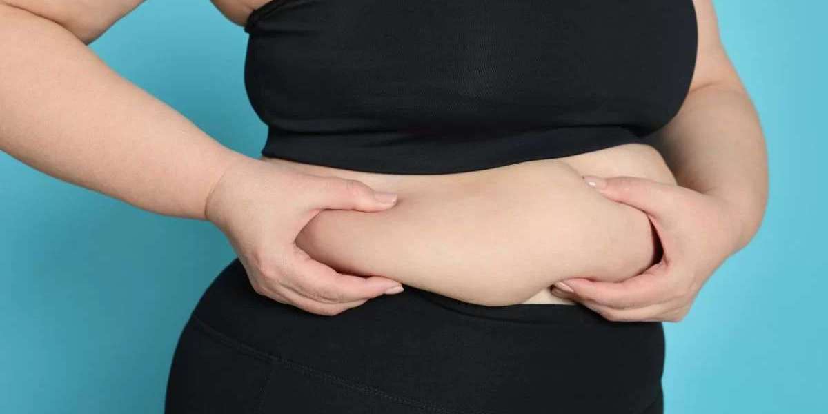 Bariatric Surgery in Islamabad – Complete Guide