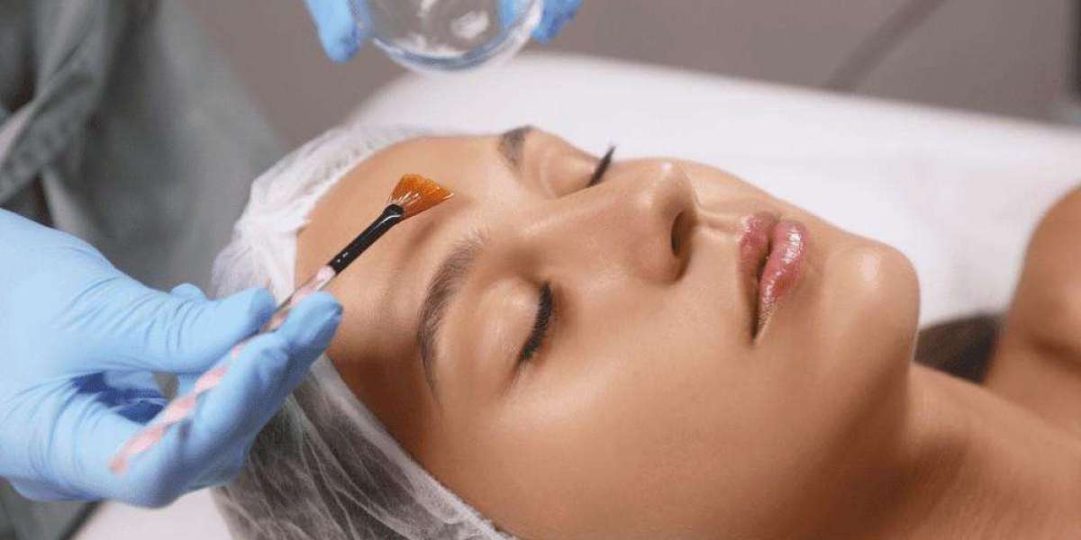 Feel Confident with Chemical Peels Islamabad in Skin