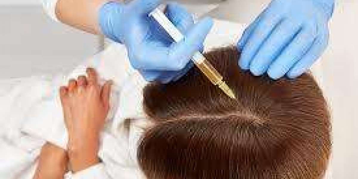 Can PRP Help Strengthen Hair Shaft Structure Long-Term?
