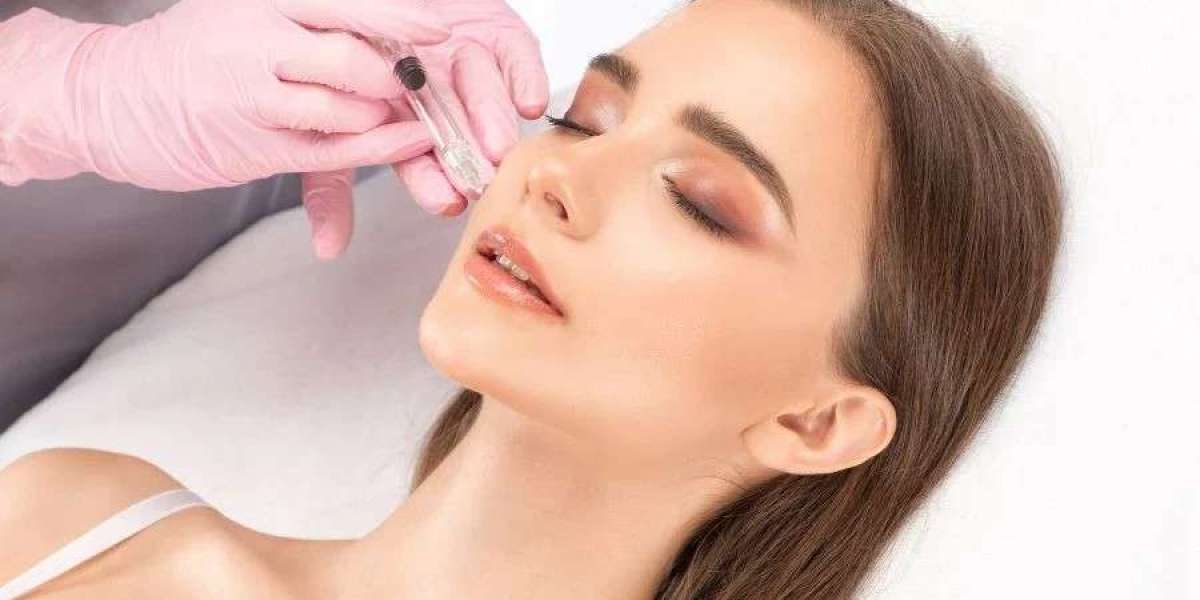Dermal Fillers for Effortless Beauty