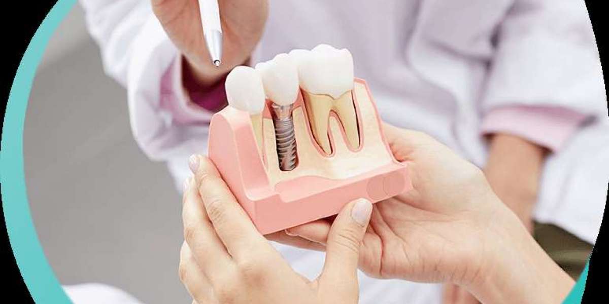 Missing Teeth? Discover How Dental Implants Can Change Your Life