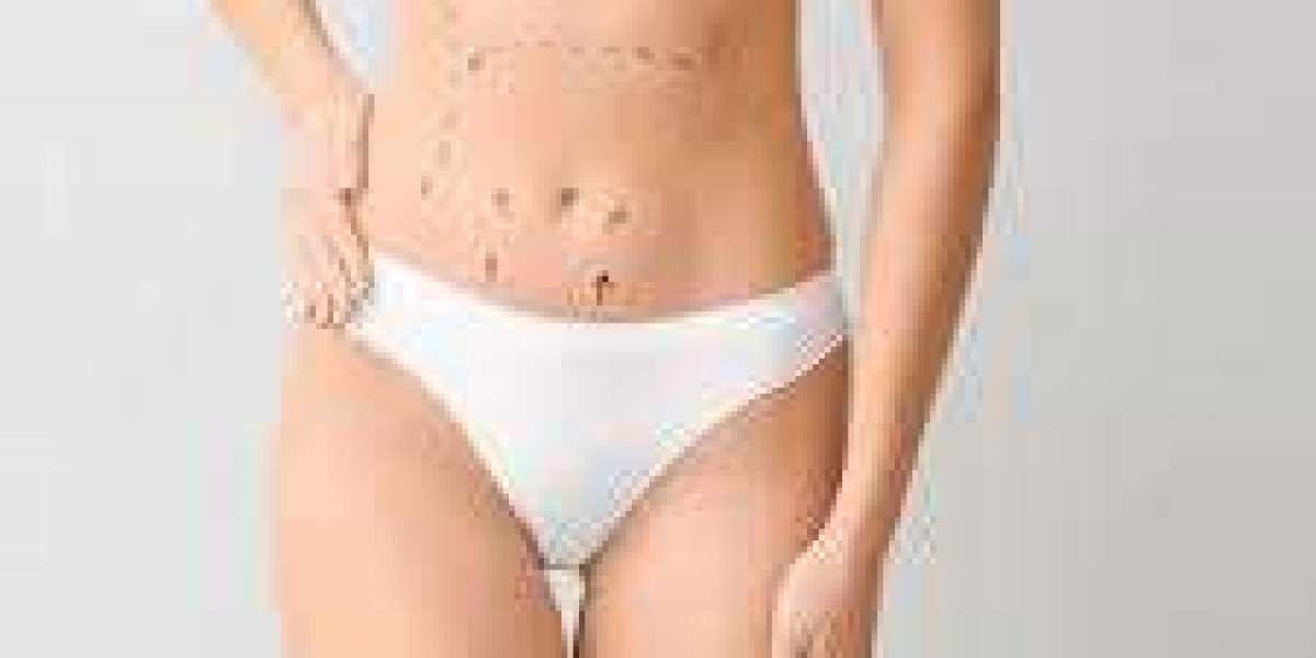 Liposuction for Body Contouring in Dubai: A Complete Guide to Sculpting Your Ideal Shape