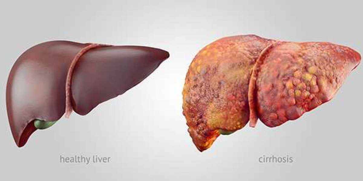 Liver Complex UK Review: Ingredients, Benefits & Real Results Explained