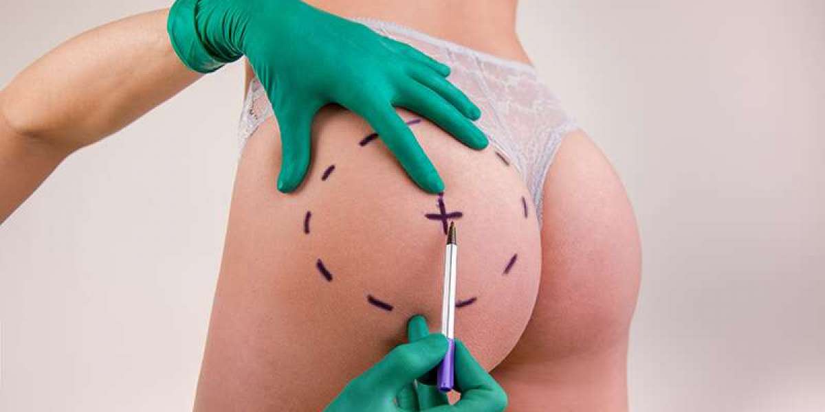 Immediate Butt Volume Boost in Dubai | Glamorous Clinic in Dubai
